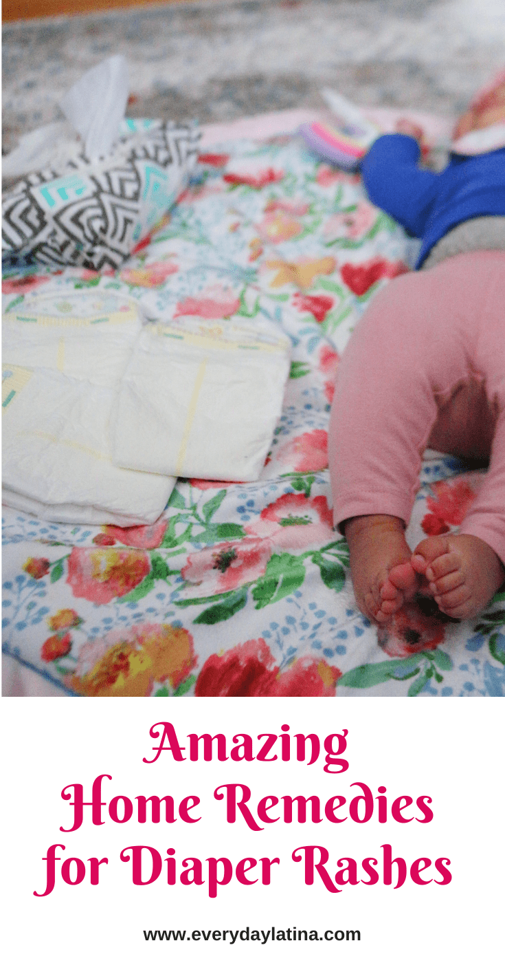 The Two Best Diaper Rash Home Remedies Everyday Latina